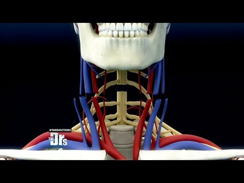 Is Head Transplant Surgery Possible?