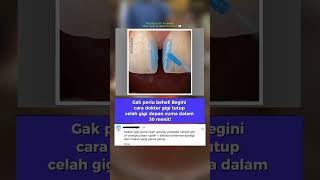 Download lagu kalian mau gak? biar estetik giginy😎 mp3