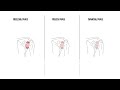Understanding Frozen Shoulder (Adhesive capsulitis)