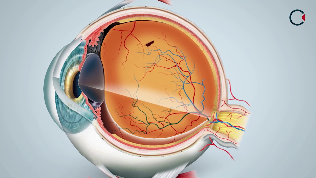 Males da Retina