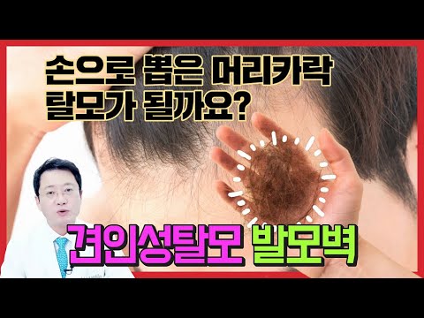 견인성탈모 발모벽 뽑은 머리카락 탈모 영구적인 탈모가 되는지 다시 모발이 자라는지 루트에 물어보았씁니다.