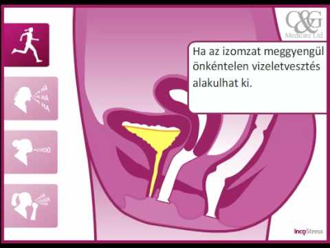 Prostate cancer screening medscape