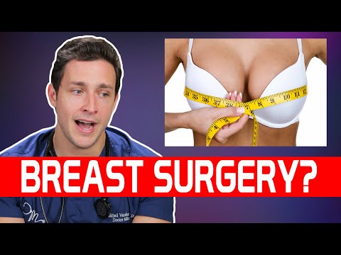 download lagu mp3 mp4 Breast Reduction Reddit, download lagu Breast Reduction Reddit gratis, unduh video klip Breast Reduction Reddit