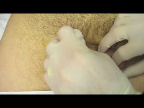 download lagu mp3 mp4 How To Shave Scrotum, download lagu How To Shave Scrotum gratis, unduh video klip How To Shave Scrotum