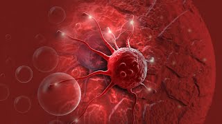 صورة " سرطان " بقى " خُرّاج " بدعوة ! | ربنا قادر على كل شئ | " عرفة يوم تحقيق المعجزات " | د. حازم شومان