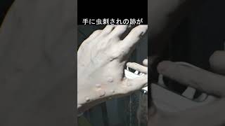 手に虫刺されの跡　#バイオハザード7 #re7