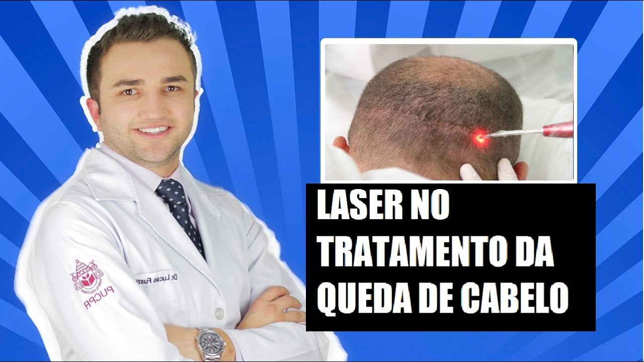 Laser no Tratamento da Queda de Cabelo - Dr Lucas Fustinoni