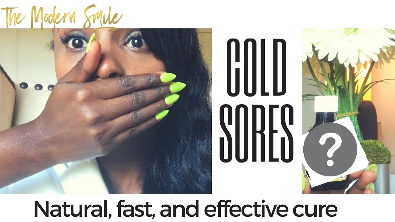 How to Heal and Cure a Cold Sore Overnight....Fast, Natural, and It Works!!