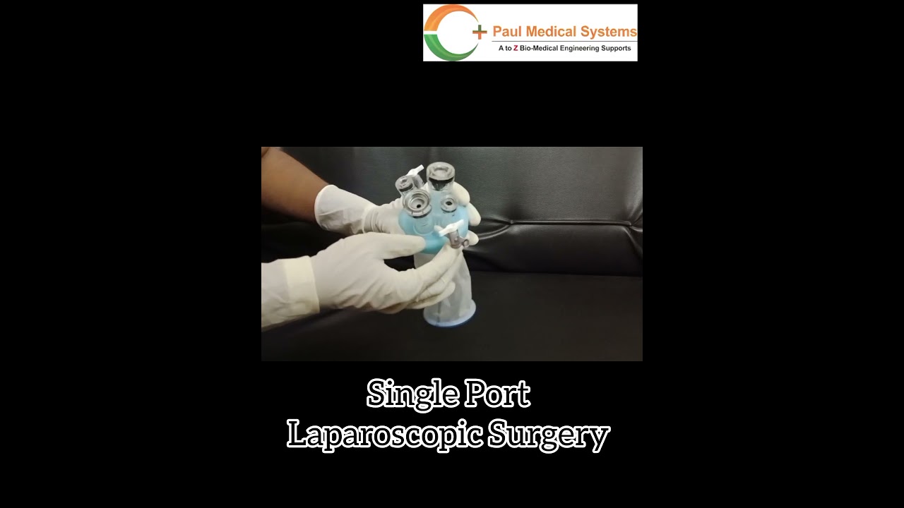 Single port Laparoscopic surgery #laparoscopictechniques #laparoscopysurgery #laparoscopicsurgeon