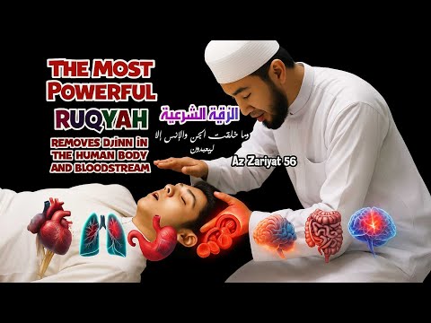Burn the Jinn and Satan that disturb your body with Ruqyah