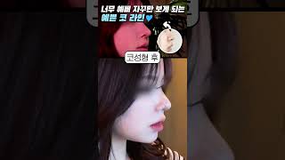코 유형별로 알아보는 코성형 핵심 point!