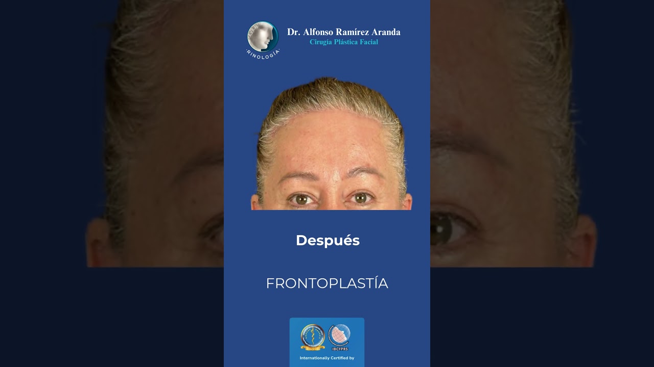 Alfonso Ramírez Aranda-45