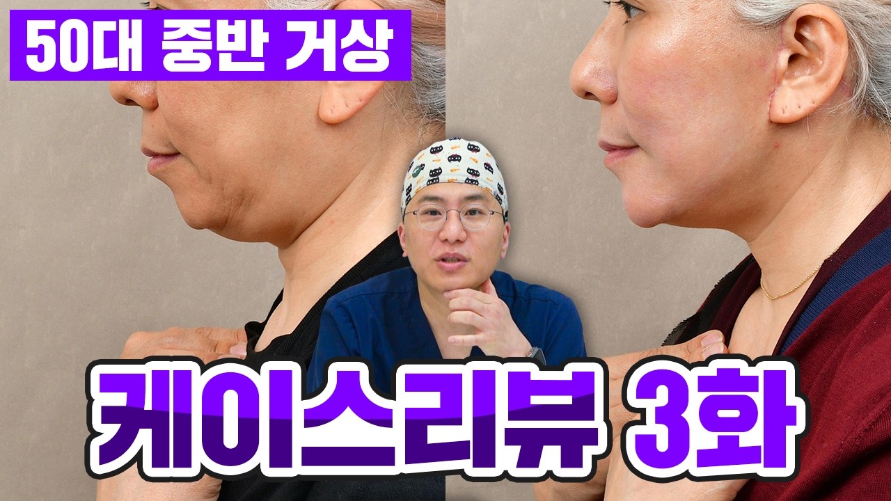 영상 썸네일