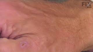 Whirlpool Dryer Repair: How to Replace the Thermal Fuse