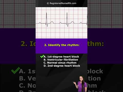 ECG Interpretation Pop Quiz: Identify The EKG Rhythms #shorts