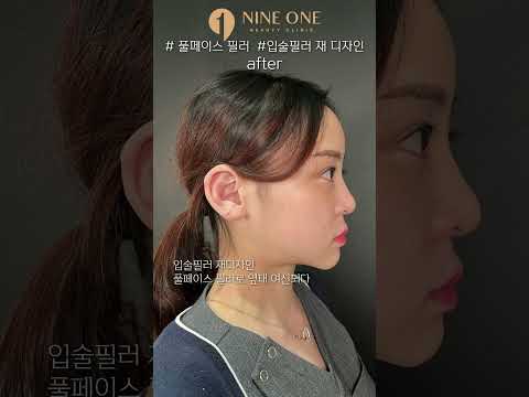 풀페이스 필러 이미지 변신 썸네일