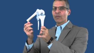 preview picture of video 'What Is A Fibula Fracture In Personal Injury Cases In Michigan City, Indiana? | (219) 874-4878'