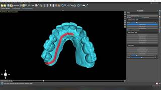 Creating a printable model in Blue Sky Plan - walkthrough
