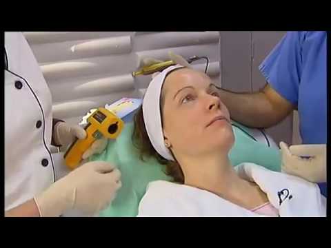 download lagu mp3 mp4 Beacon Dermatology, download lagu Beacon Dermatology gratis, unduh video klip Beacon Dermatology