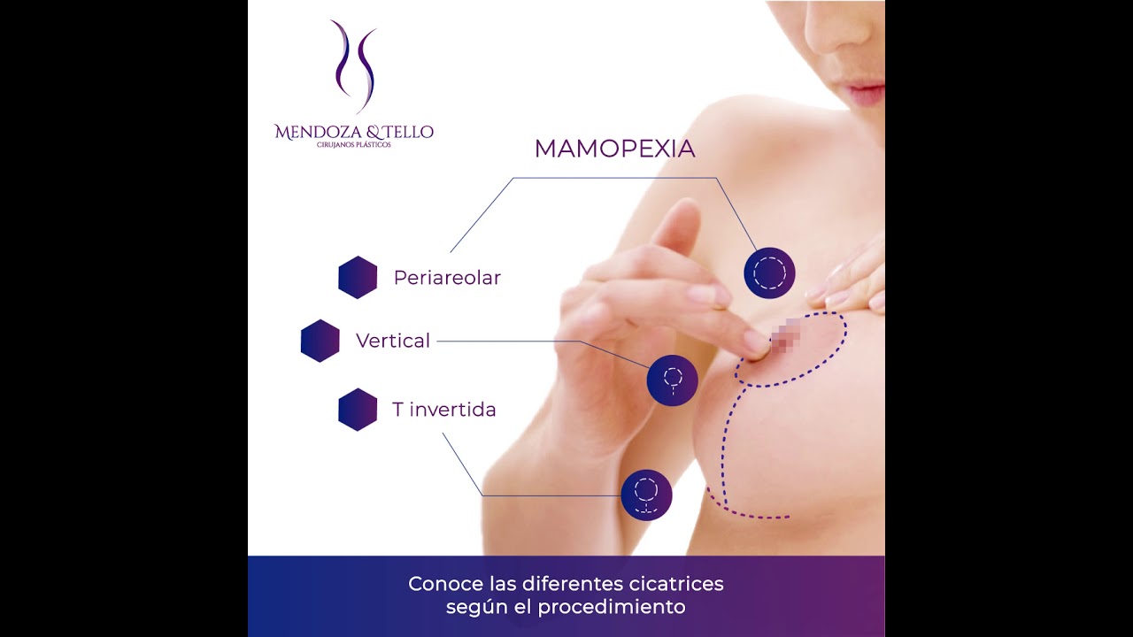 Alexander Mendoza-112