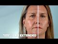 Scientists Are Closer Than Ever To Reverse Aging How Does It Work Life Extended