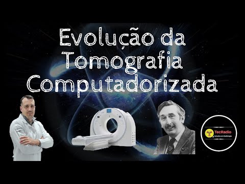 EVOLUÇÃO DA TOMOGRAFIA COMPUTADORIZADA