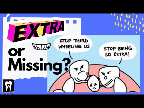 Developmental anomalies | teeth anomalies | supernumerary teeth | Anadontia