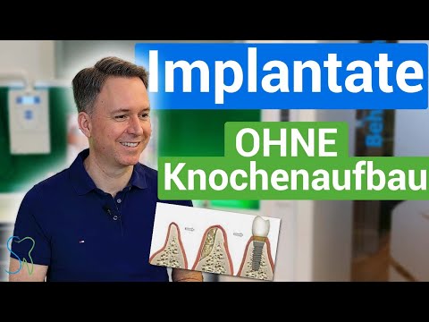 Dental implants WITHOUT bone grafting – options for upper and lower jaw