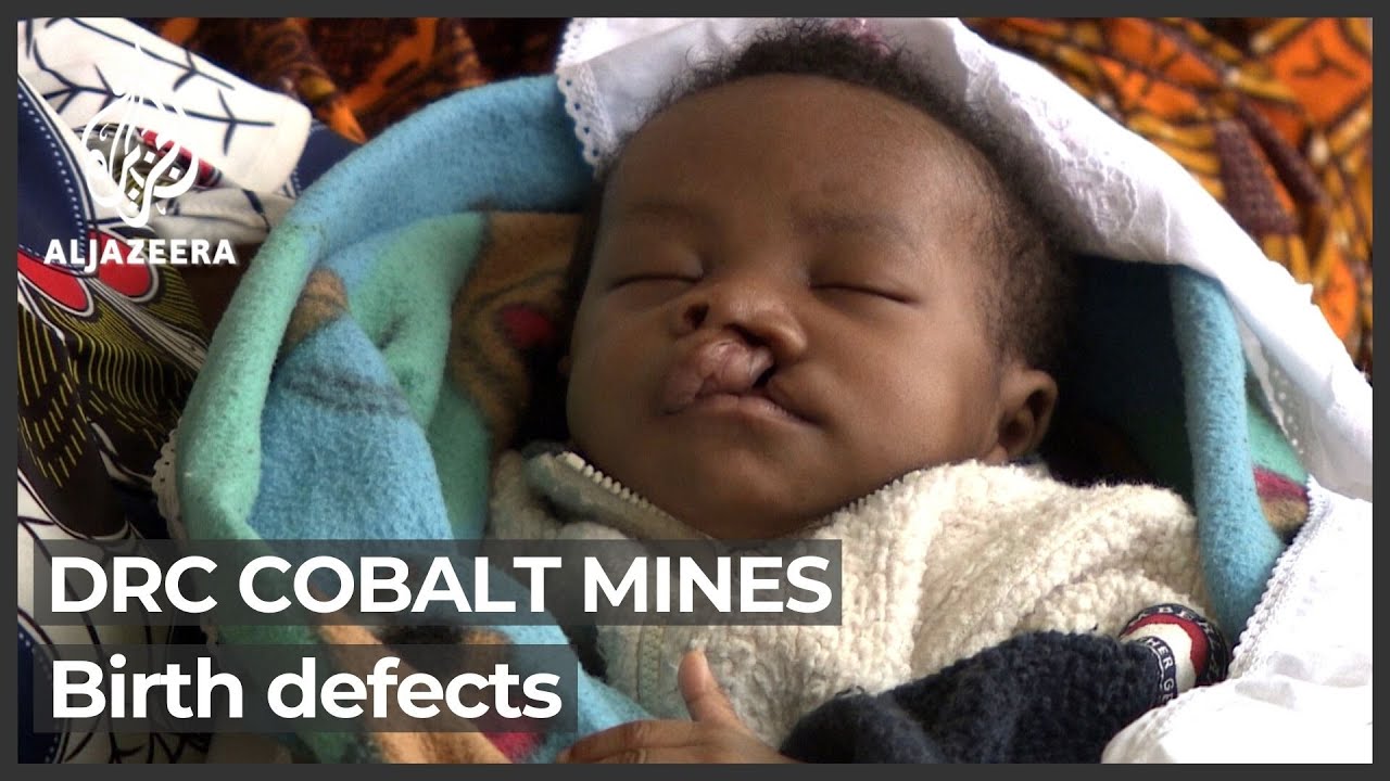 Babies born with deformities near DRC&rsquo;s cobalt mines - YouTube