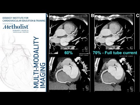 Cardiac CT: Current Technology & Principles (Faisal Nabi, MD, FACC) September 11, 2018