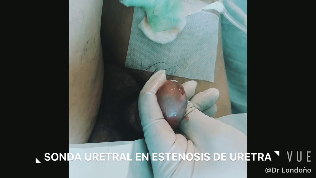 Carlos Londoño Martínez-17