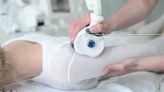 Download the video "ICOONE Laser"