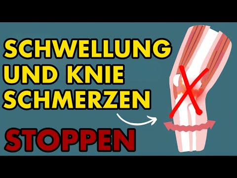 Entdecke in 10 Min: Deine Lösung für Knie-Schmerz & Schwellung!