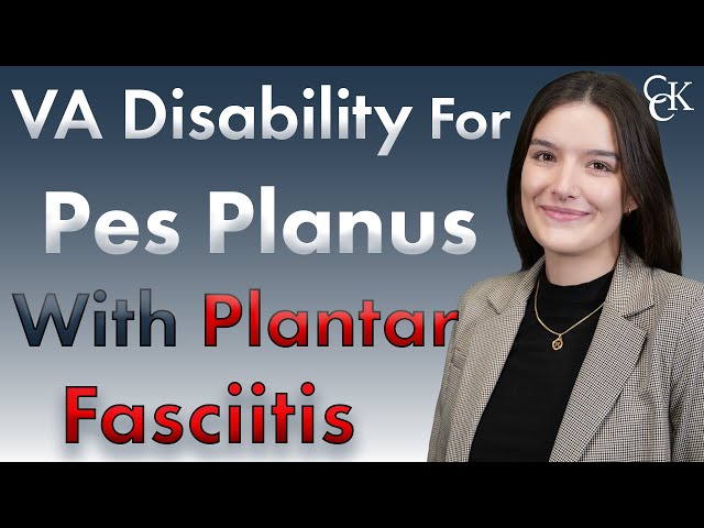 VA Disability Benefits For Pes Planus With Plantar Fasciitis