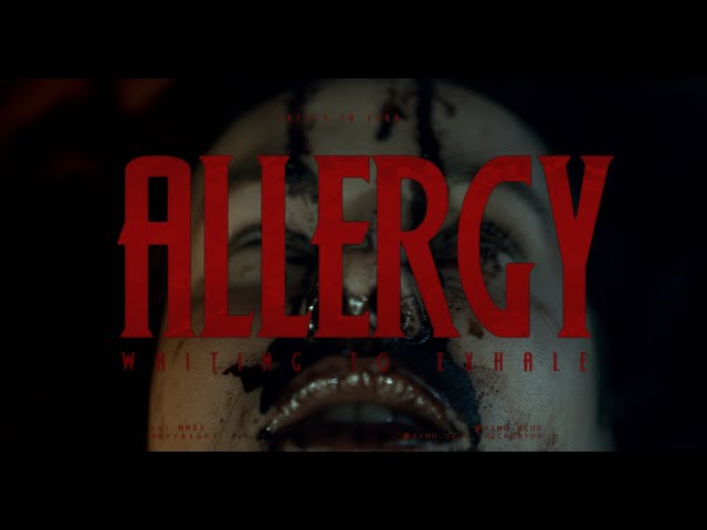 This girl’s allergic reaction is way more sinister than she expects #shorts #fyp #horror