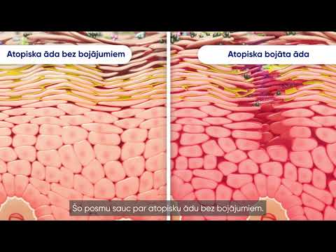 BEPANTHEN Anti-Exem krēms 50 g