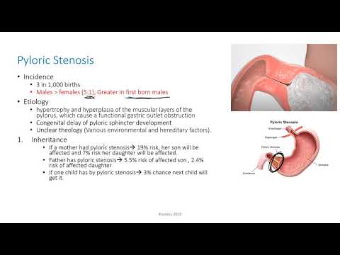 Bilious and non bilious vomiting