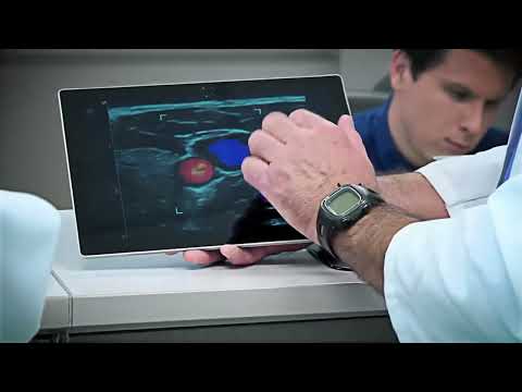 Ультразвуковая система Siemens ACUSON Freestyle