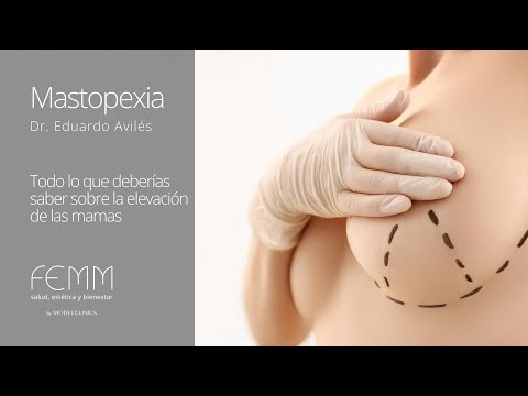 ¿Qué es la mastopexia?