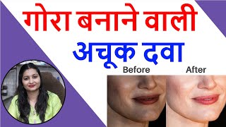चेहरे को गोरा करे | Gora Hone Ka Tarika | Gora Hone Ka Face Wash | Gora Hone Ki Homeopathic Medicine