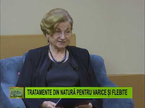 începator varicose garden tratament recenzii