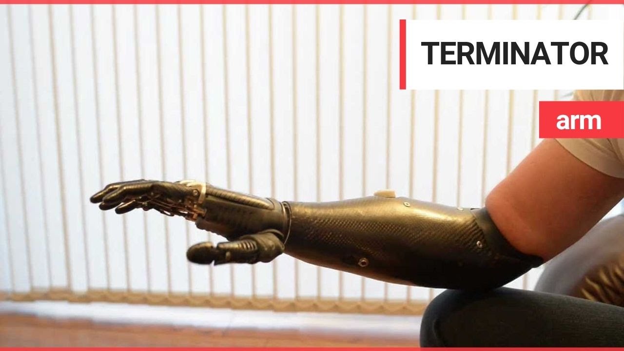 This Prosthetic Hand Could Have Been Ripped From A Terminator