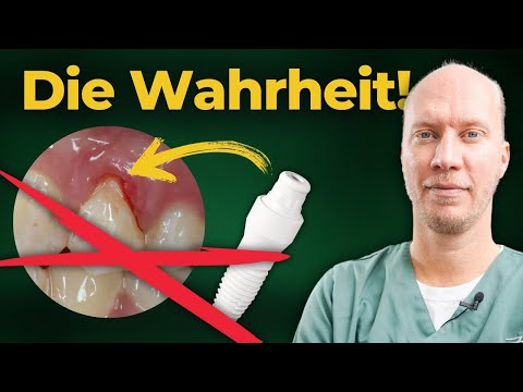 Wann sind Zahnimplantate KEINE gute Wahl?
