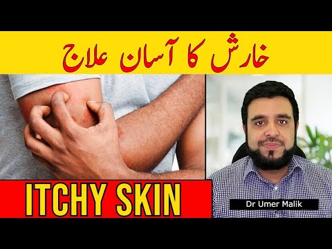Itchy Skin: Kharish Ka Ilaj | Kharish Khatam Karne Ka Tarika | Khujli Ka Ilaaj | Khaarish Ka Elaj