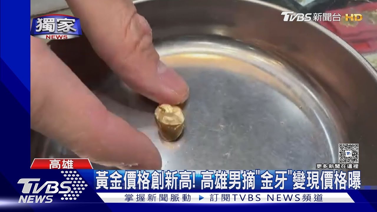 金價飆破歷史新高!男拔「金牙」變現 銀樓揭成交價翻倍了