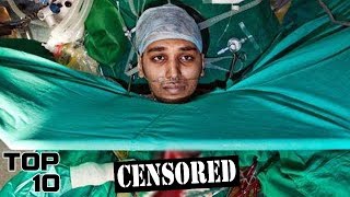 Top 10 Scary Times People Woke Up In Surgery