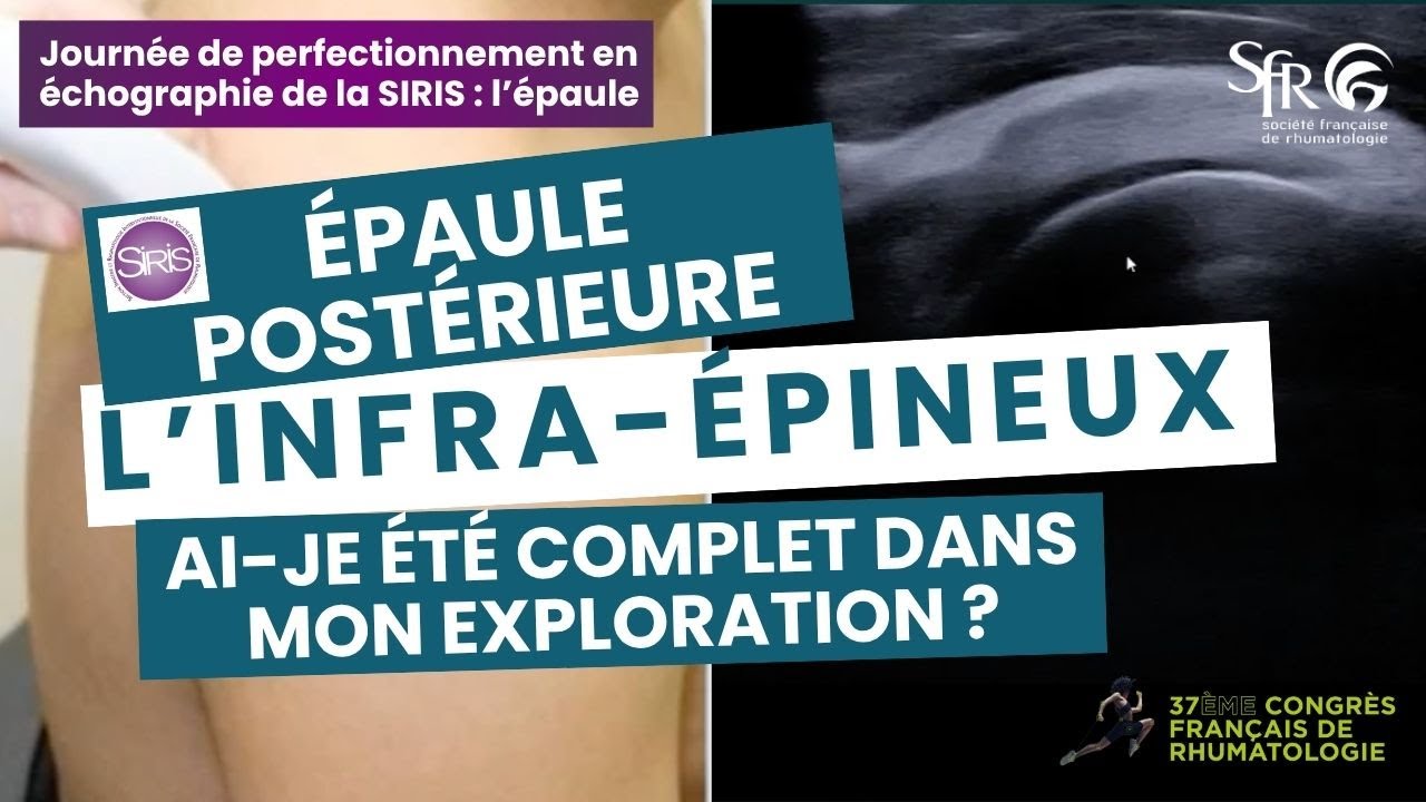 Journée de perfectionnement en échographie de la SIRIS