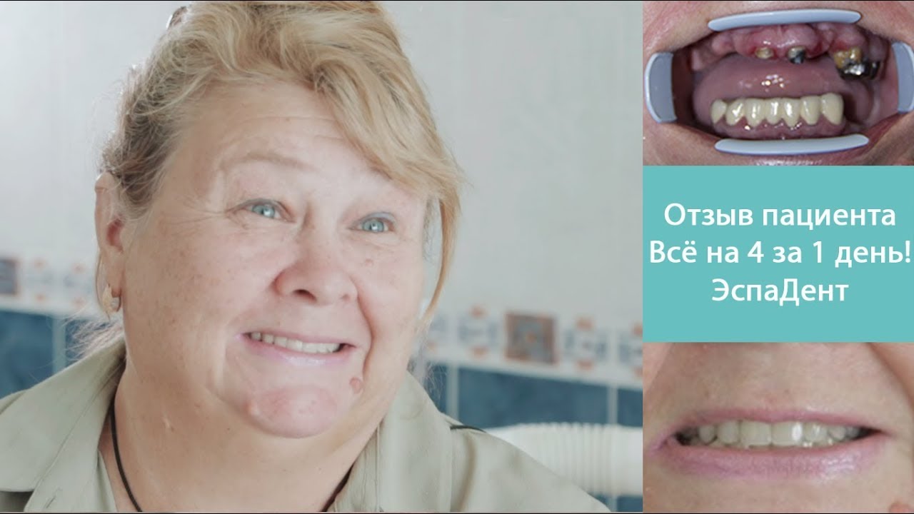 имплантация зубов в барнауле в кредит