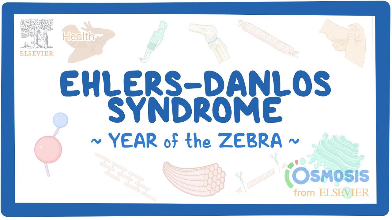 Ehlers-Danlos syndrome (Year of the Zebra)