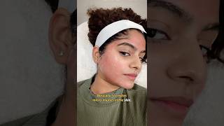 I got  MICRONEEDLING Done 🤯😵‍💫🤭 #microneedling #acnescars #acne #pigmentation